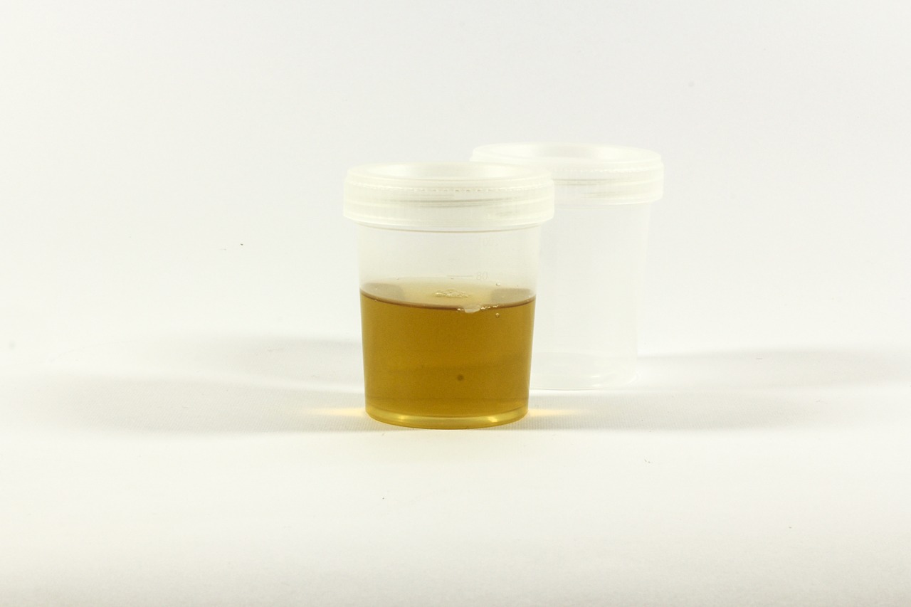 the test urine container urine free photo