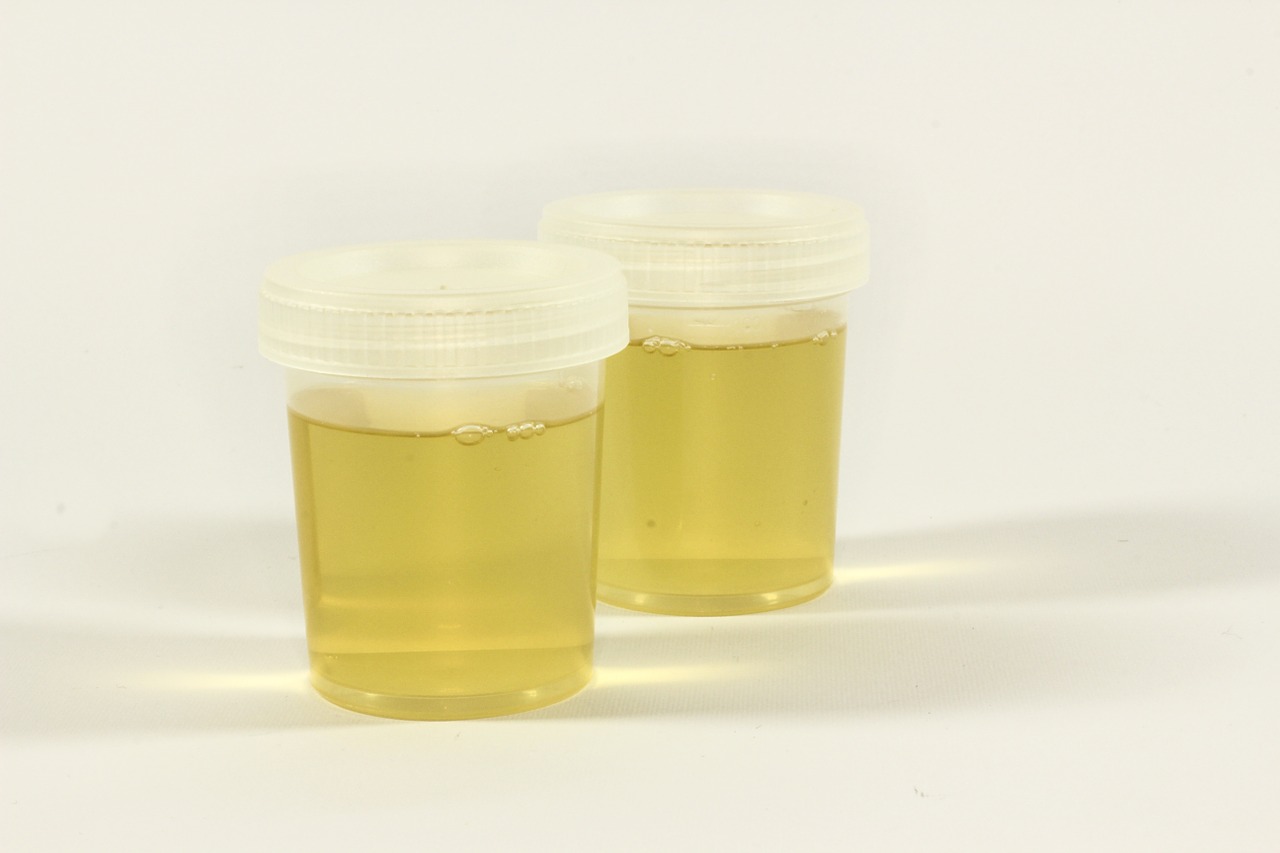 the test urine container urine free photo