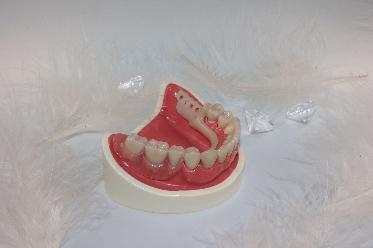 tooth replacement tooth dental technician free photo