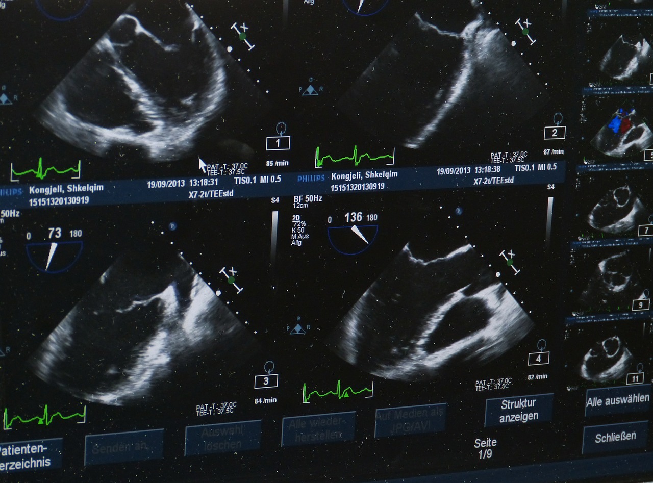 ultrasound x ray image hospital free photo