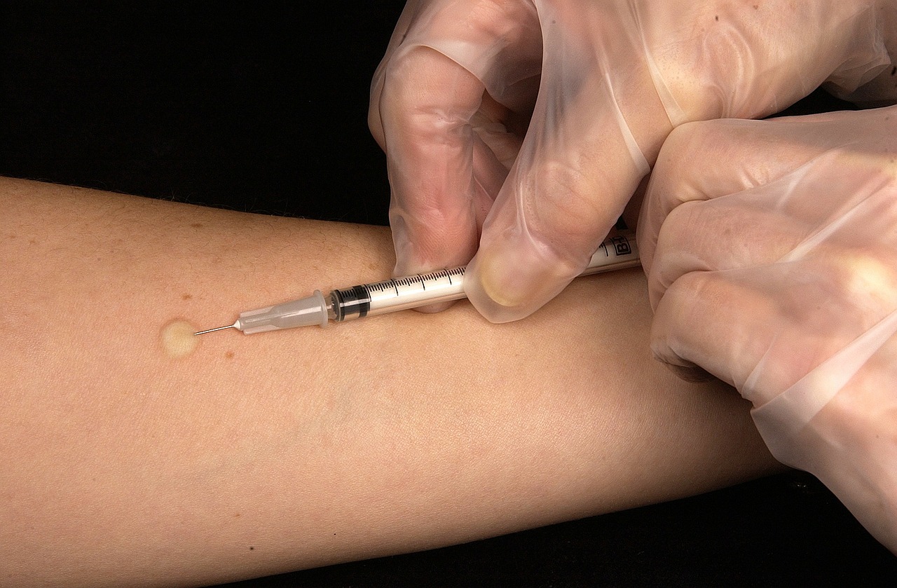 vaccination tuberculin test syringe free photo