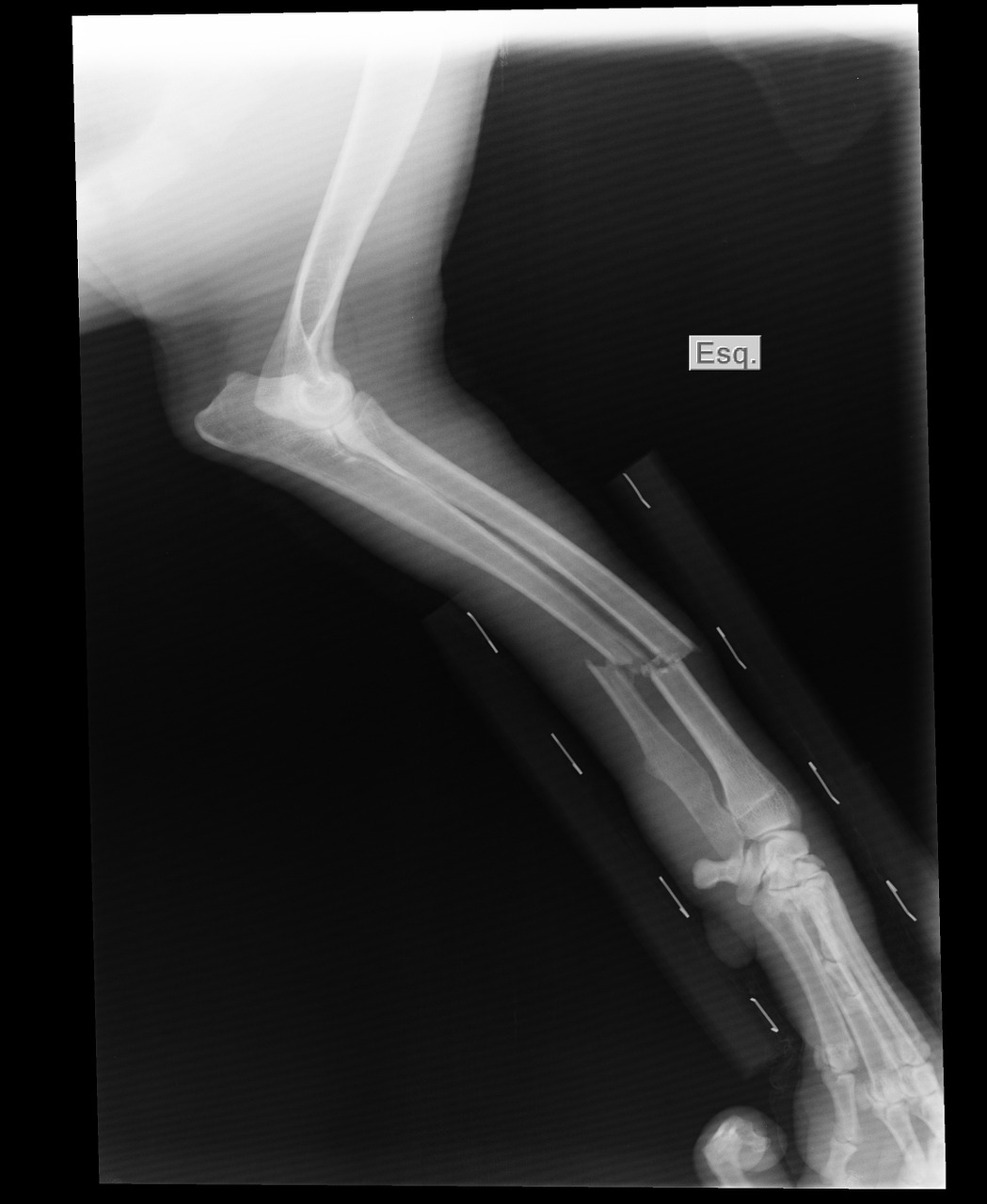 broken arm x-ray shin free photo