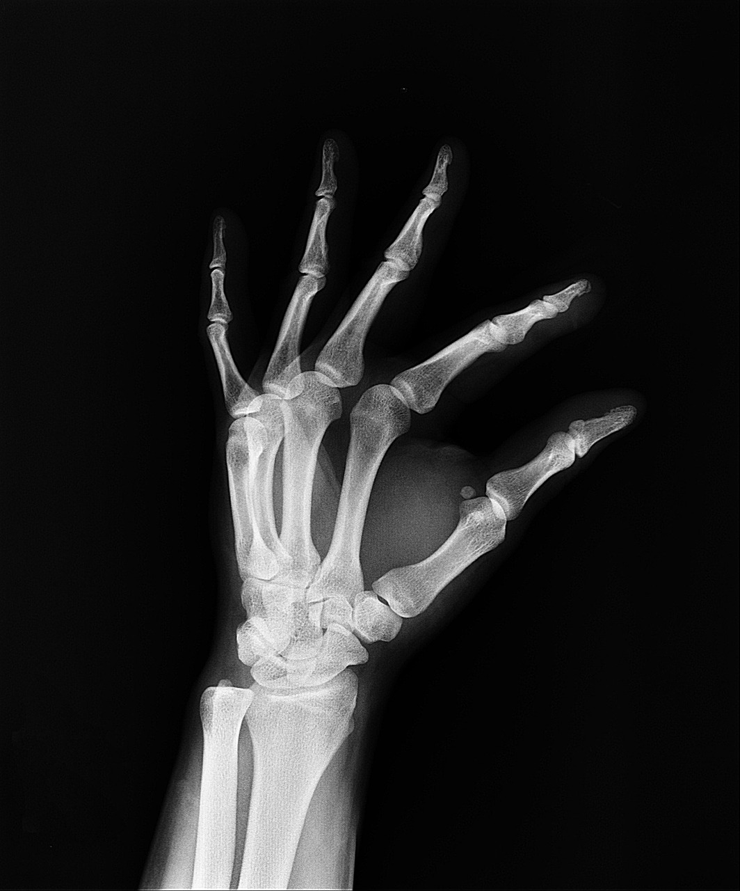 x-ray health arm free photo