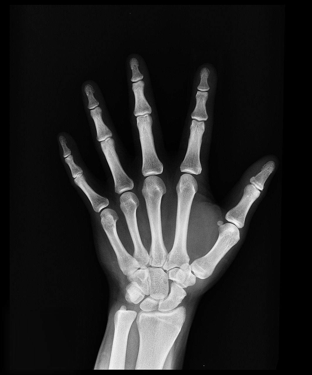 x-ray health arm free photo