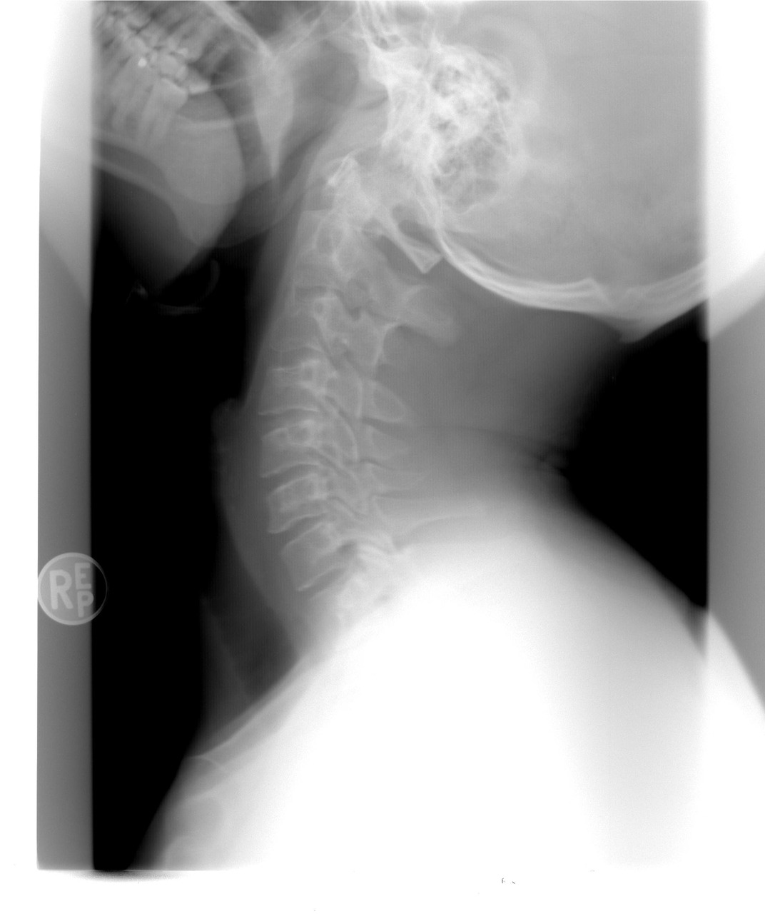xray cervical spine healthcare free photo