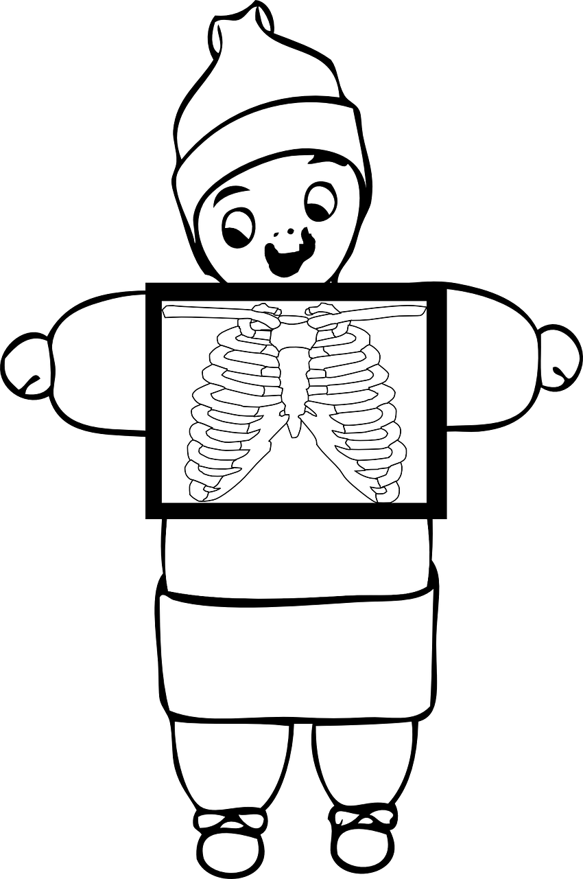 xray chest ribcage free photo