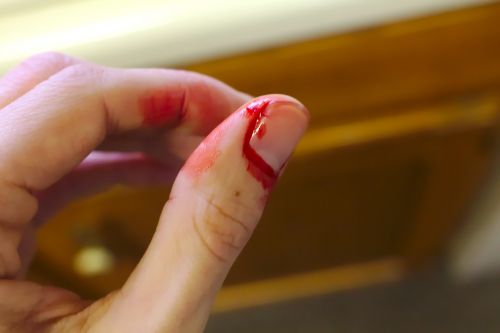 accident bleed bleeding