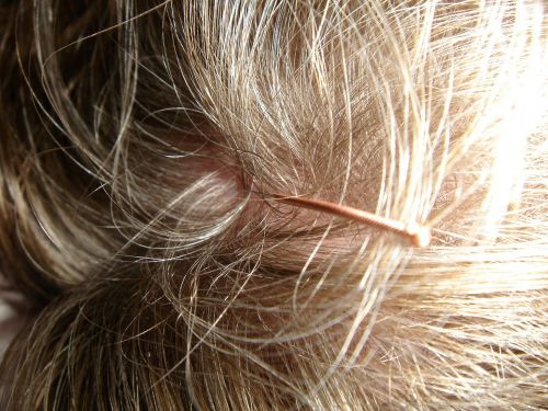 acupuncture acupuncture needle scalp