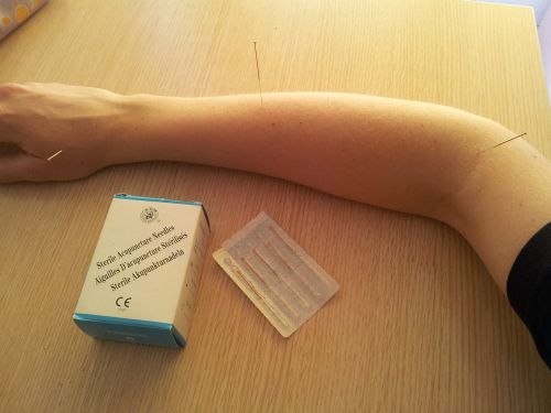 acupuncture acupuncture needles traditional chinese medicine