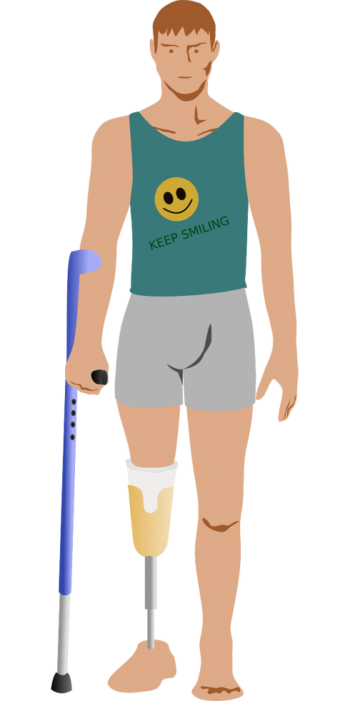 amputation prosthetics leg