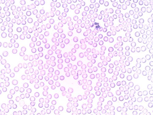 blood neutrophil segmented neutrophil