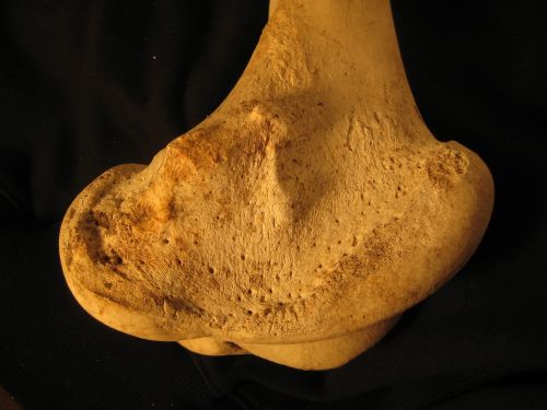 bone femur skeleton
