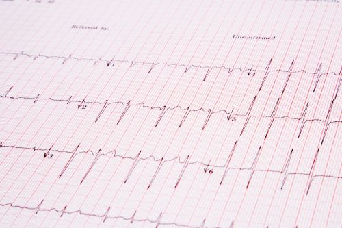 Cardiogram Pulse Trace