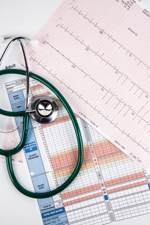 Cardiogram Pulse Trace