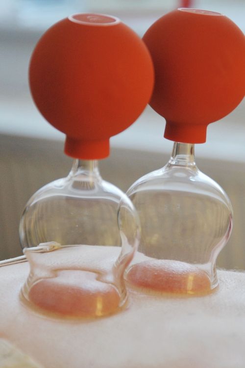 cupping glasses heal therapy