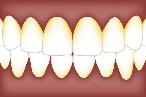 dental  plaque  biofilm