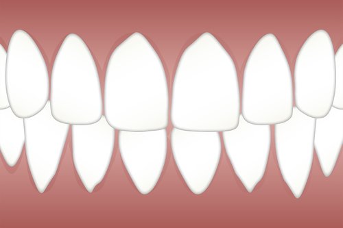 dental  periodontal  disease