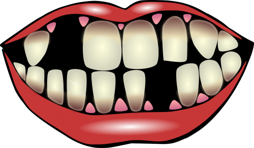 dental hygiene dental care falling out of teeth