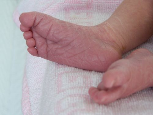 feet baby skin