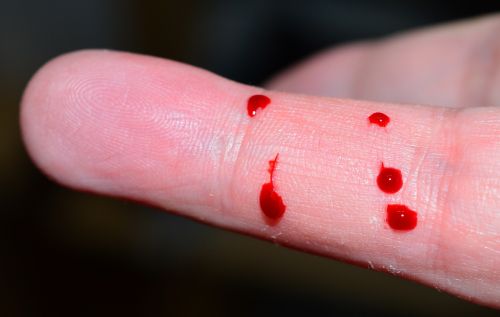finger blood drip
