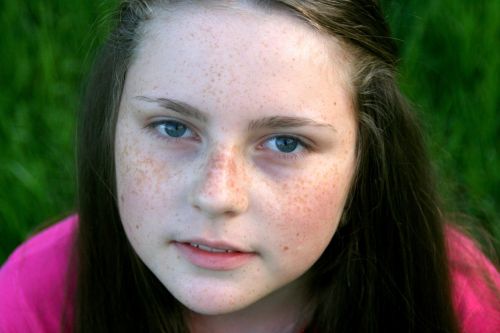 freckle face portrait grass
