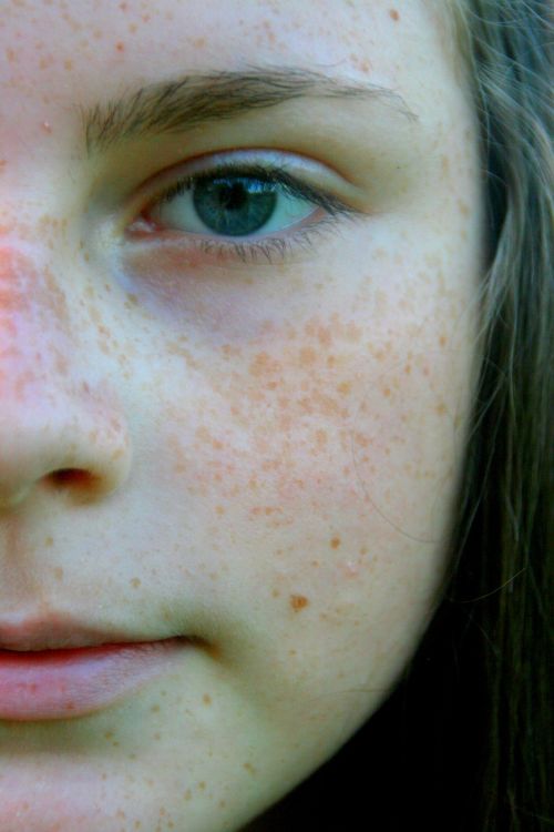 freckle face portrait blue eyes