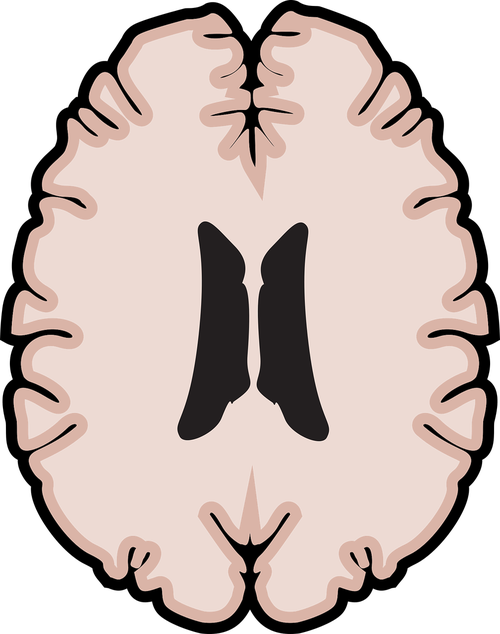 graphic  brain  horizontal brain