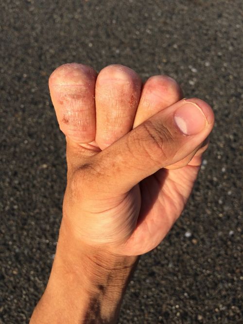 hand finger nail