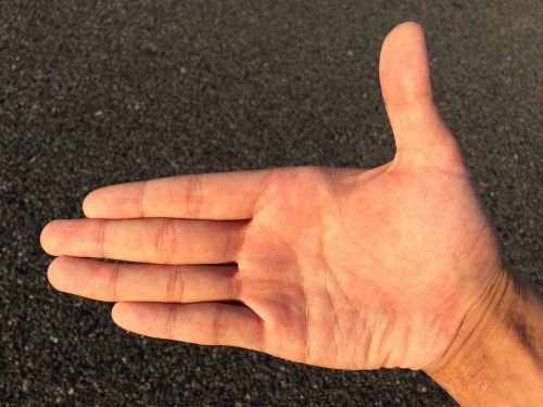 hand finger skin