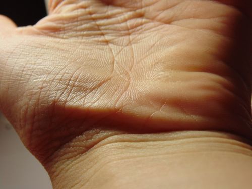 hand palm skin