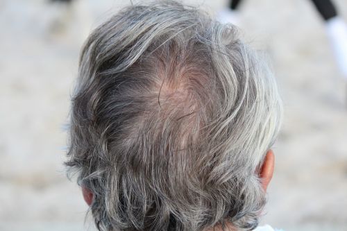 head hair grey