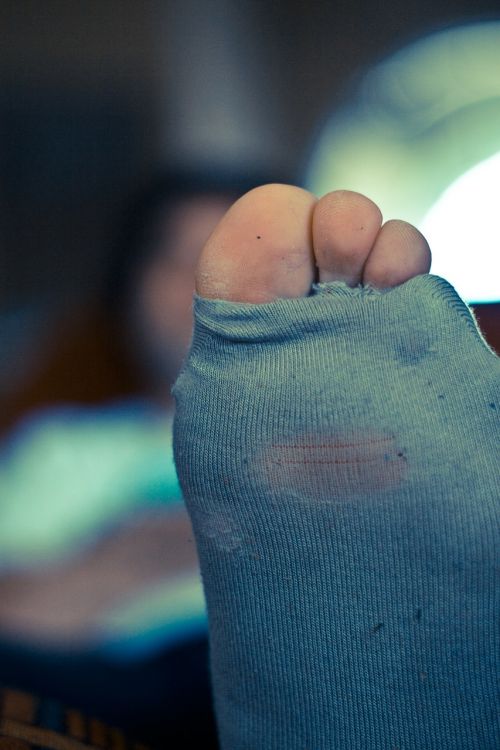 holes socks toes