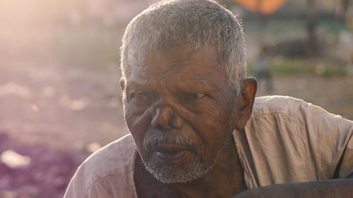 india leprosy beggars