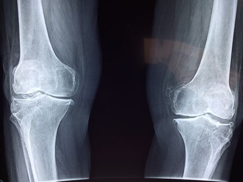 knee x-ray medical