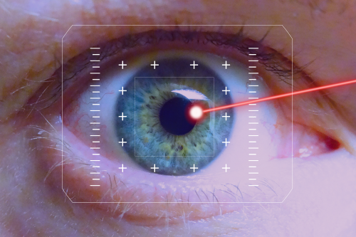 lasers eye iris