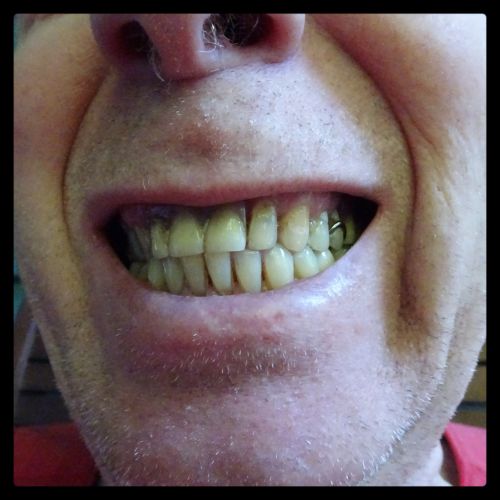 Man Showing Teeth