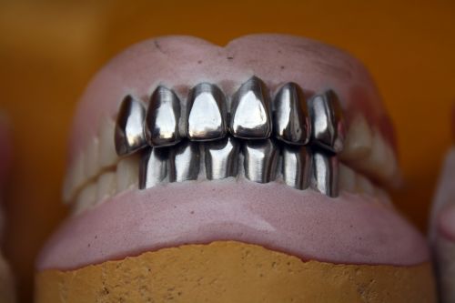 metal teeth dental denture