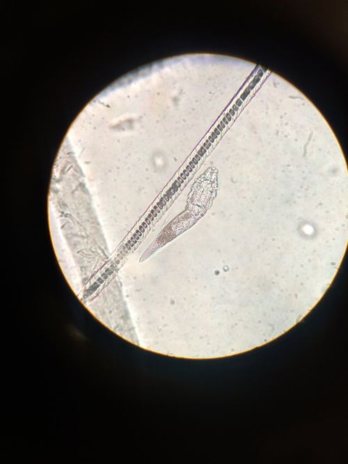 microscope mites demodex