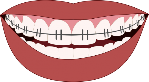 orthodontics smile teeth