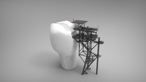 platform building tooth