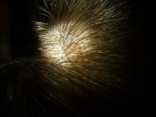scalp mole head