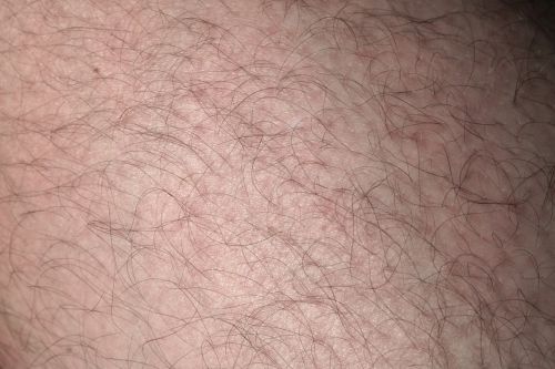 skin hair leg