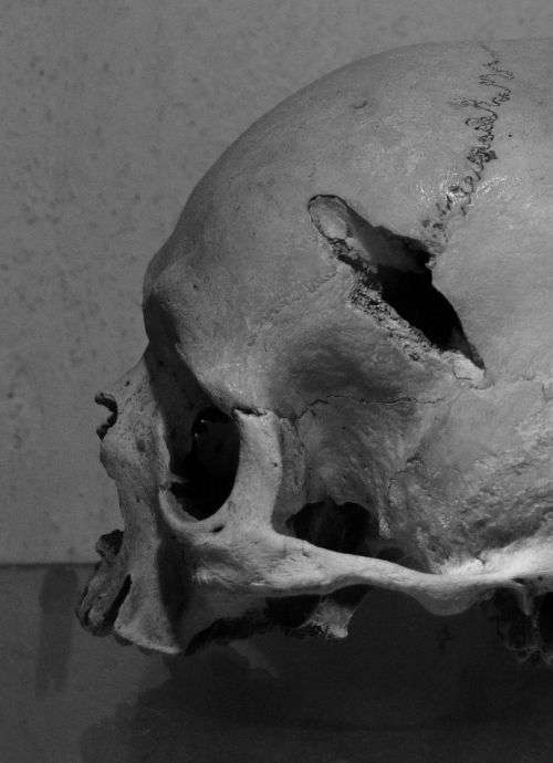 skull bones head