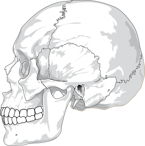 skull cracked head