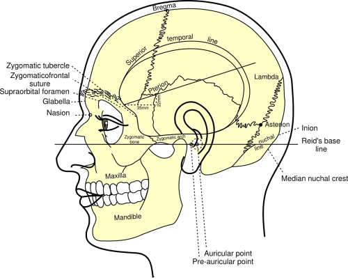 skull diagram head