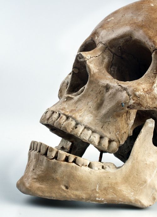 skull color teeth