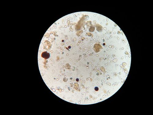 soil microbes microscope soil sample