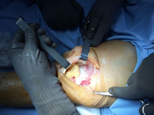 surgery surgeon treatment
