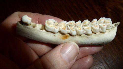 teeth tooth dental caries