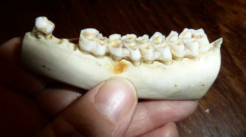 teeth tooth dental caries